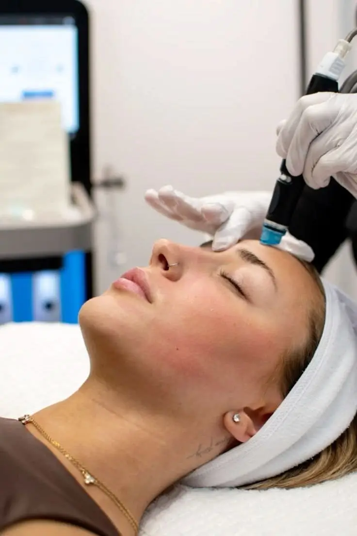 Microneedling - Package of 3 sessions