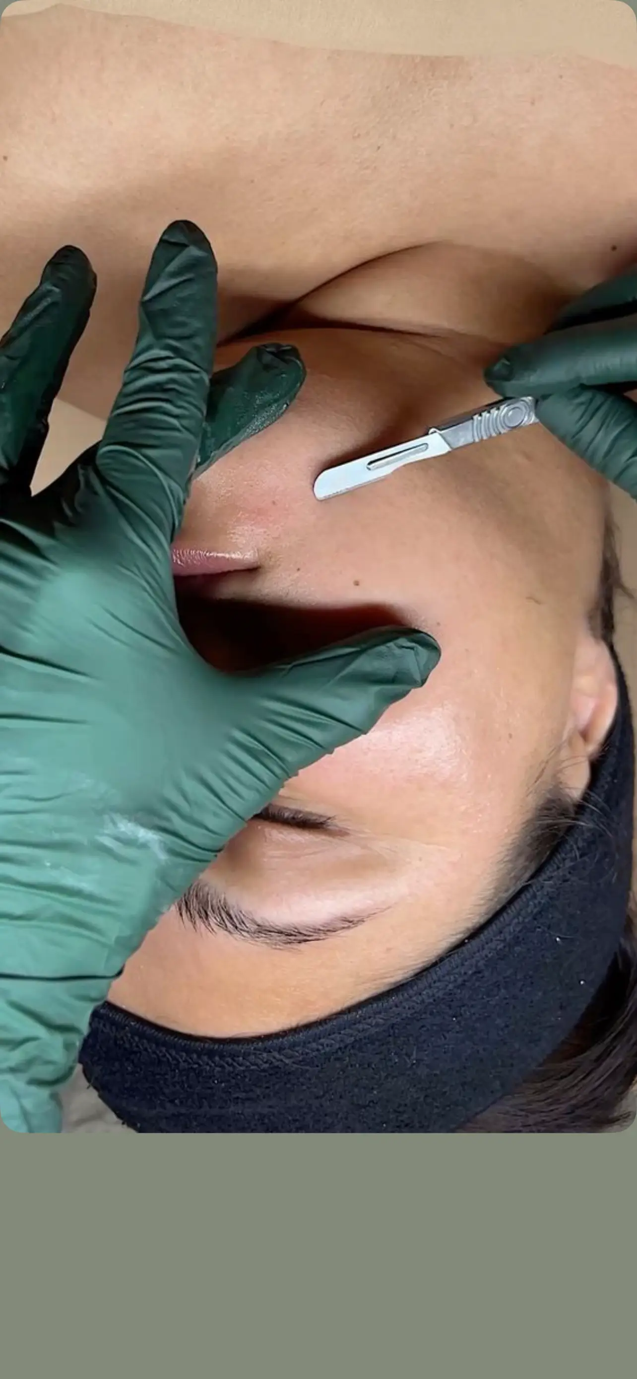 Dermaplaning Facial